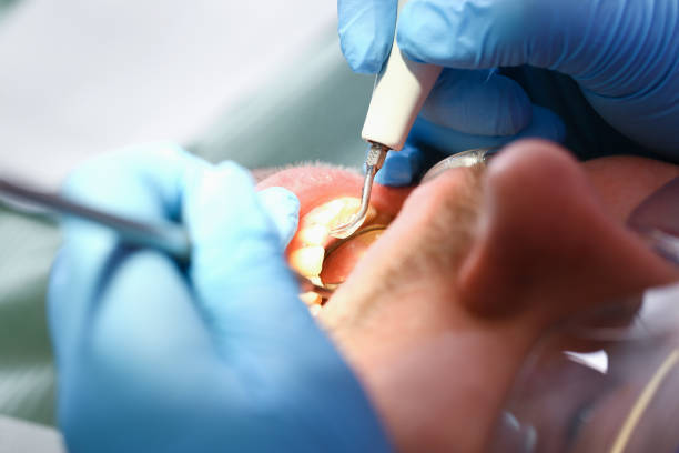 Best Broken or Chipped Tooth Repair in Hawi, HI
